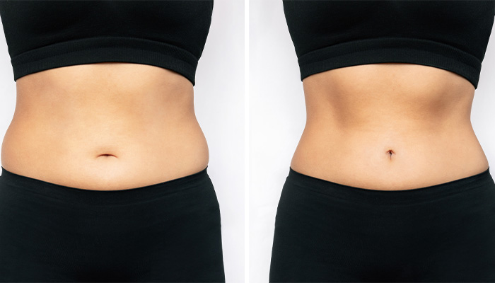 muscle toning
